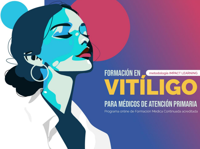Formación en Vitíligo para Médicos de Familia